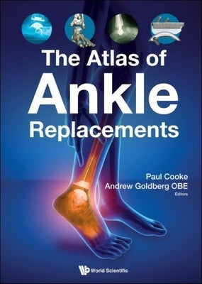 The Atlas of Ankle Replacements by Goldberg Obe, Andrew J.