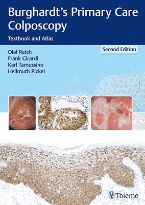 Burghardt's Primary Care Colposcopy: Textbook and Atlas by Reich, Olaf