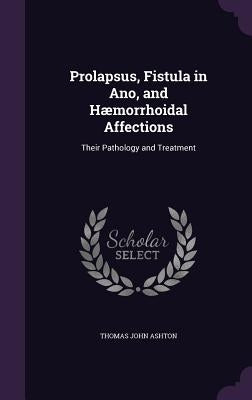 Prolapsus, Fistula in Ano, and Hæmorrhoidal Affections: Their Pathology and Treatment by Ashton, Thomas John
