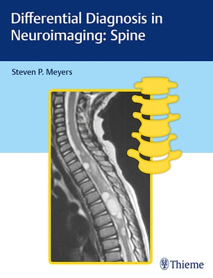 Differential Diagnosis in Neuroimaging: Spine by Meyers, Steven