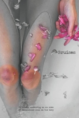 Bruises by Poetry Publishing, Dark Thirty