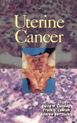 Uterine Cancer by Luesley, David M.