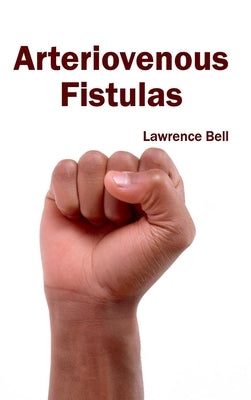 Arteriovenous Fistulas by Bell, Lawrence