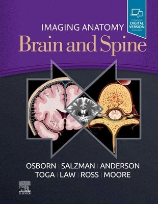 Imaging Anatomy Brain and Spine by Osborn, Anne G.
