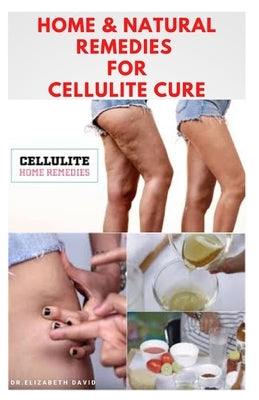 Home & Natural Remedies for Cellulite Cure: Practical Guide On The Best Remedies To Get Rid Of Your Cellulite: Everything You Need To Know by David, Dr Elizabeth