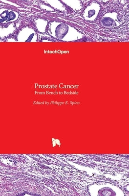 Prostate Cancer: From Bench to Bedside by Spiess, Philippe E.
