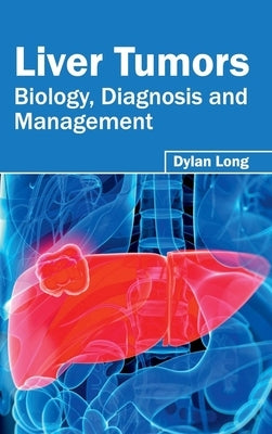 Liver Tumors: Biology, Diagnosis and Management by Long, Dylan