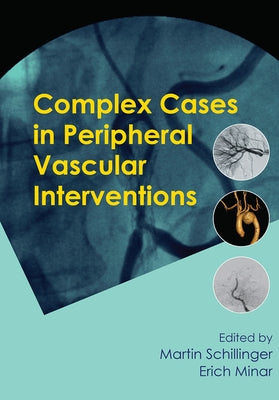 Complex Cases in Peripheral Vascular Interventions by Schillinger, Martin