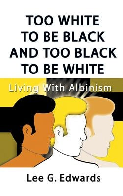 Too White to Be Black and Too Black to Be White: Living with Albinism by Edwards, Lee G.