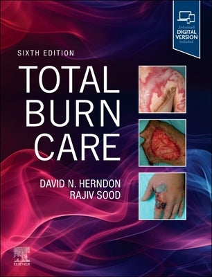 Total Burn Care by Herndon, David