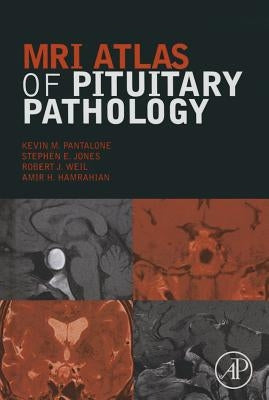 MRI Atlas of Pituitary Pathology by Pantalone, Kevin M.