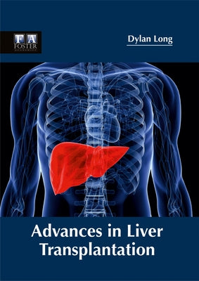 Advances in Liver Transplantation by Long, Dylan