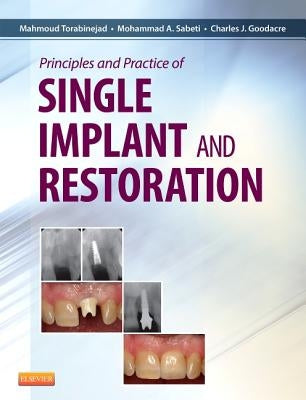 Principles and Practice of Single Implant and Restoration by Torabinejad, Mahmoud
