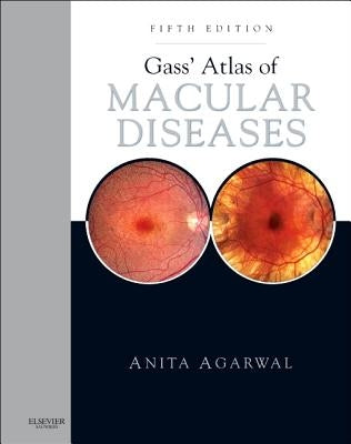 Gass' Atlas of Macular Diseases: 2-Volume Set - Expert Consult: Online and Print by Agarwal, Anita