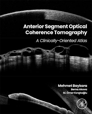Anterior Segment Optical Coherence Tomography: A Clinically-Oriented Atlas by Baykara, Mehmet