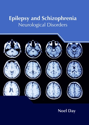 Epilepsy and Schizophrenia: Neurological Disorders by Day, Noel
