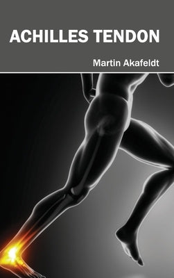 Achilles Tendon by Akafeldt, Martin