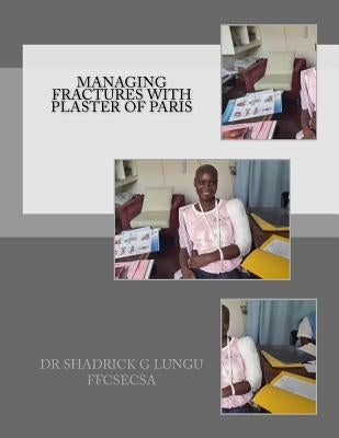 Managing Fractures with Plaster of Paris: A Practical Guide for Health Professionals by Lungu, Shadrick G.