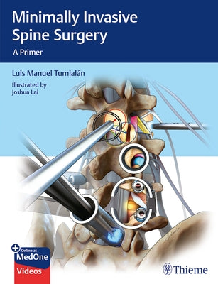Minimally Invasive Spine Surgery: A Primer by Tumialan, Luis Manuel