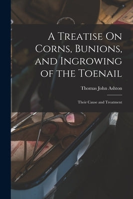 A Treatise On Corns, Bunions, and Ingrowing of the Toenail: Their Cause and Treatment by Ashton, Thomas John