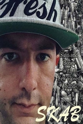 Skab: Skin and Bones with a Few Closed Wounds by Lincoln, Scotty