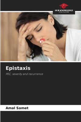 Epistaxis by Samet, Amal