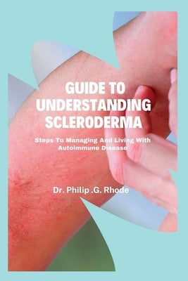 Guide to Understanding Scleroderma: Steps to managing and living with autoimmune disease by Rhode, Philip G.