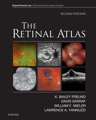 The Retinal Atlas by Freund, K. Bailey