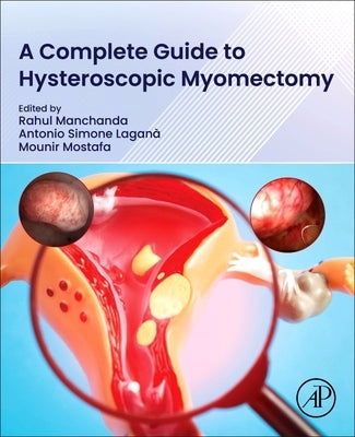 A Complete Guide to Hysteroscopic Myomectomy by Manchanda, Rahul