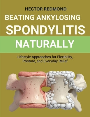 Beating Ankylosing Spondylitis Naturally: Lifestyle Approaches for Flexibility, Posture, and Everyday Relief by Redmond, Hector