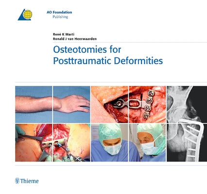 Osteotomies for Posttraumatic Deformities by Marti, René K.