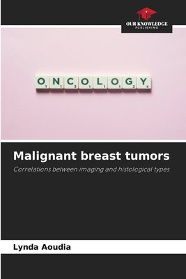 Malignant breast tumors by Aoudia, Lynda