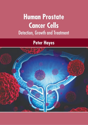 Human Prostate Cancer Cells: Detection, Growth and Treatment by Hayes, Peter
