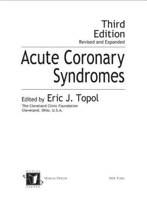 Acute Coronary Syndromes by Topol, Eric