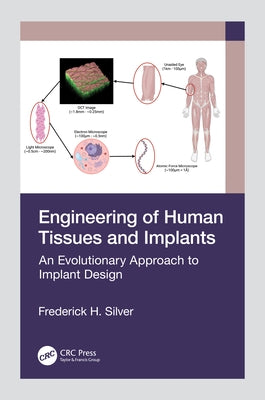 Engineering of Human Tissues and Implants: An Evolutionary Approach to Implant Design by Silver, Frederick H.