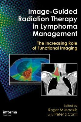 Image-Guided Radiation Therapy in Lymphoma Management: The Increasing Role of Functional Imaging by Macklis, Roger M.
