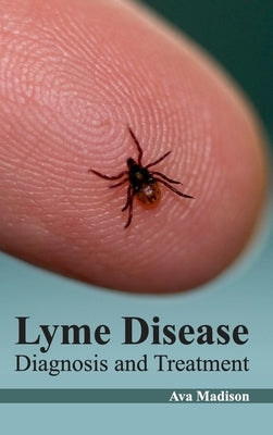 Lyme Disease: Diagnosis and Treatment by Madison, Ava