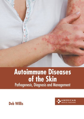 Autoimmune Diseases of the Skin: Pathogenesis, Diagnosis and Management by Willis, Deb