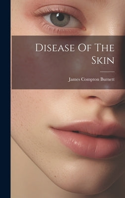 Disease Of The Skin by Burnett, James Compton