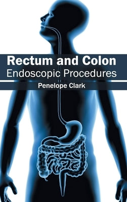 Rectum and Colon: Endoscopic Procedures by Clark, Penelope