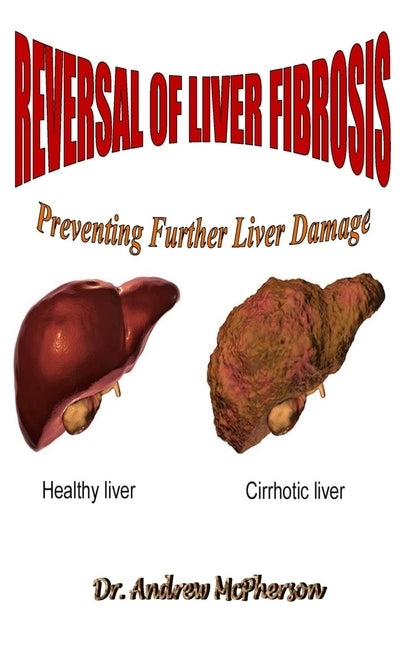Reversal of Liver Fibrosis: Preventing Further Liver Damage by McPherson, Andrew