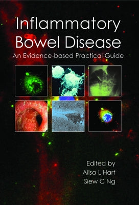 Inflammatory Bowel Disease: An Evidence-Based Practical Guide by Hart, Ailsa L.