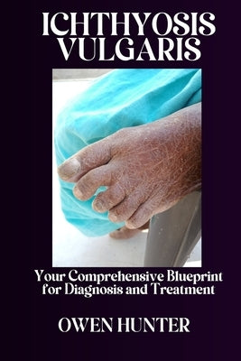 Ichthyosis Vulgaris: Your Comprehensive Blueprint for Diagnosis and Treatment by Hunter, Owen