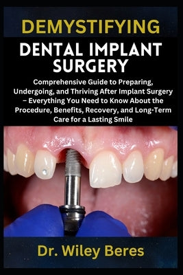 Demystifying Dental Implant Surgery: Comprehensive Guide to Preparing, Undergoing, and Thriving After Implant Surgery - Everything You Need to Know Ab by Beres, Wiley