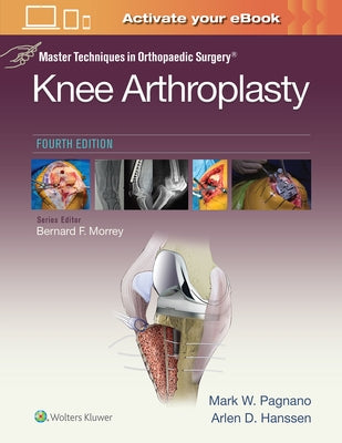 Master Techniques in Orthopedic Surgery: Knee Arthroplasty by Pagnano, Mark W.