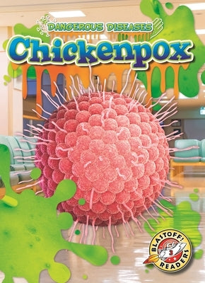 Chicken Pox by Pettiford, Rebecca