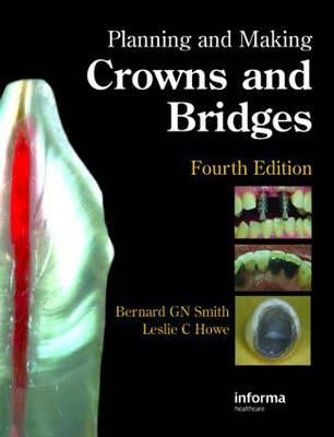 Planning and Making Crowns and Bridges by Smith, Bernard G. N.