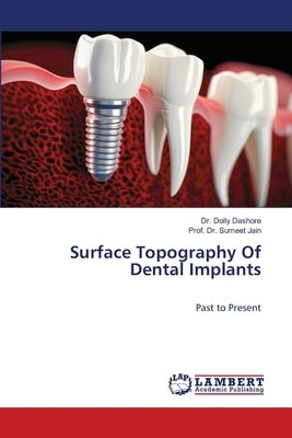 Surface Topography Of Dental Implants by Dashore, Dolly