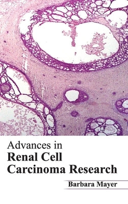 Advances in Renal Cell Carcinoma Research by Mayer, Barbara