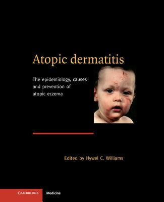 Atopic Dermatitis by Williams, Hywel C.